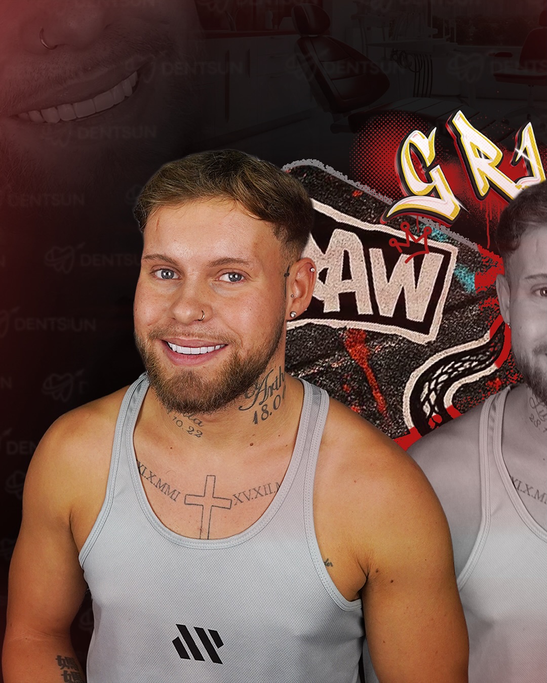 ✨ Ryan’s Smile Transformation ✨
Ryan from the UK trusted Dentsun Dental Center to achieve his dream smile.
With BL1 shade Zirconium Crowns, our team created a flawless, luminous look that enhances both his confidence and natural charm. Now Ryan’s smile speaks for itself bright, elegant, and full of life.
📞 +90 (540) 003 35 36
🔗 dentsun.com.tr