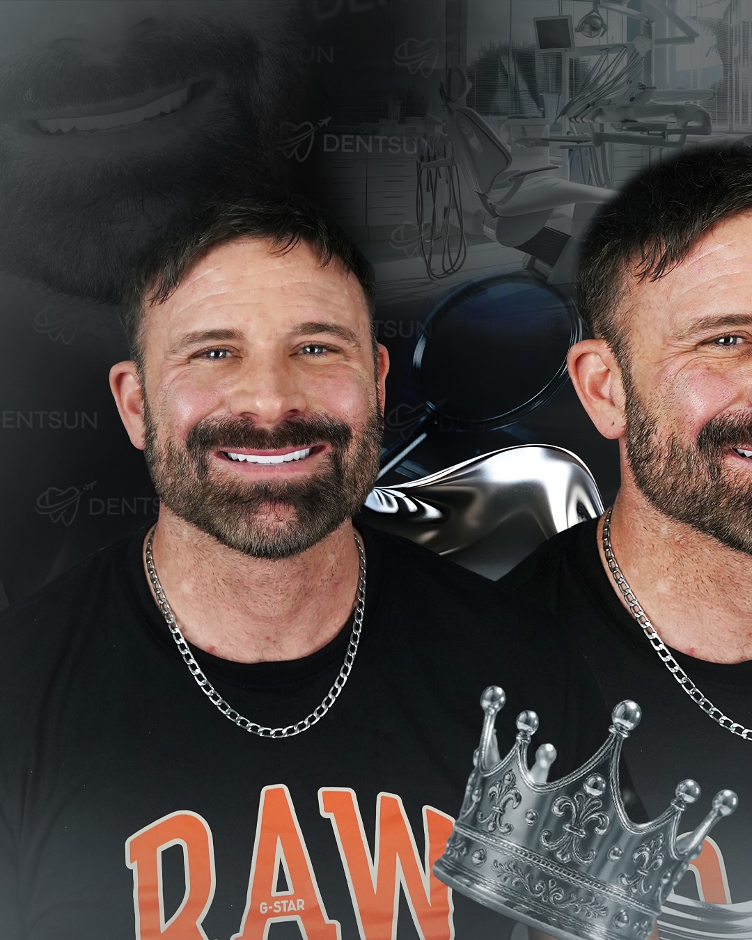 ✨ Tate’s Smile Transformation ✨
Tate from Australia trusted Dentsun Dental Center to achieve his perfect smile.
With BL1 shade Zirconium Crowns, our expert team designed a bright, balanced, and natural look that enhances his unique character. Now Tate’s smile reflects both elegance and confidence every time he laughs.
📞 +90 (540) 003 35 36
🔗 dentsun.com.tr