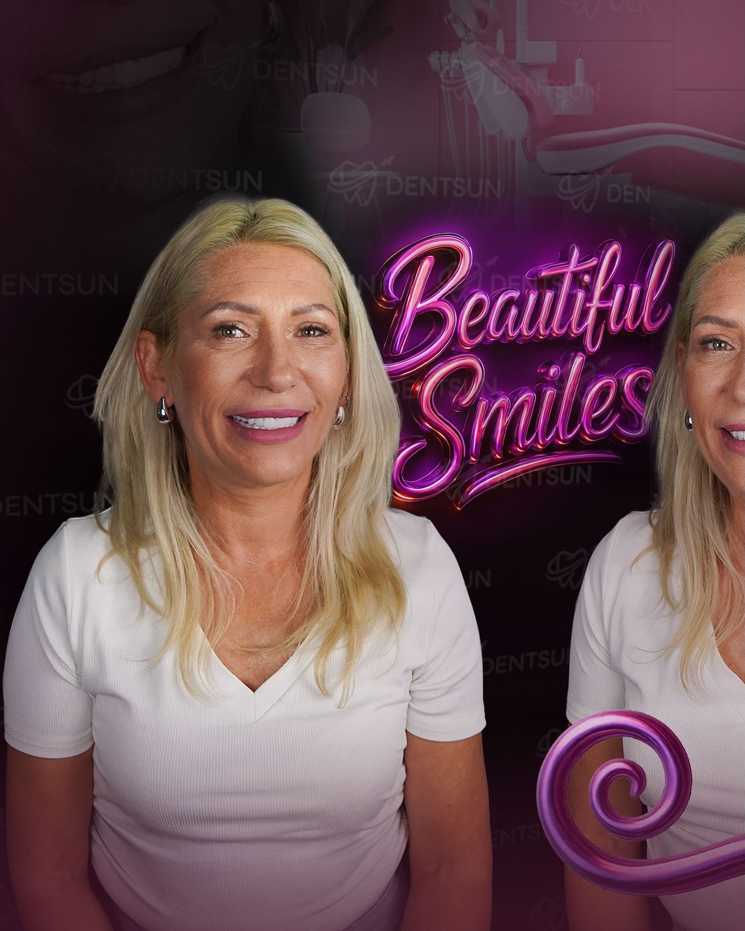 ✨ Grazyna’s Beautiful Smile ✨
Grazyna came from Poland with one goal — to rediscover her confidence through a perfect smile.
With BL2 shade Zirconium Crowns, we created a design that captures both elegance and personality. Her new smile isn’t just brighter; it’s a reflection of self-assurance, grace, and timeless beauty.
📞 +90 (540) 003 35 36
🔗 dentsun.com.tr