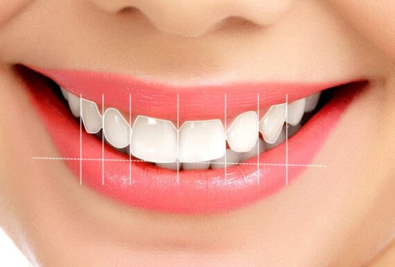 Holywood Smile
